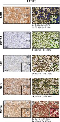 Metabolic classification of non-small cell lung cancer patient-derived xenografts by a digital pathology approach: A pilot study